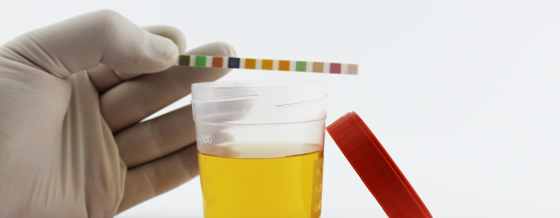 personne qui tient une bandelette au dessus d'un pot d'urine